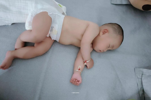 资阳六个月宝宝眼睛散光